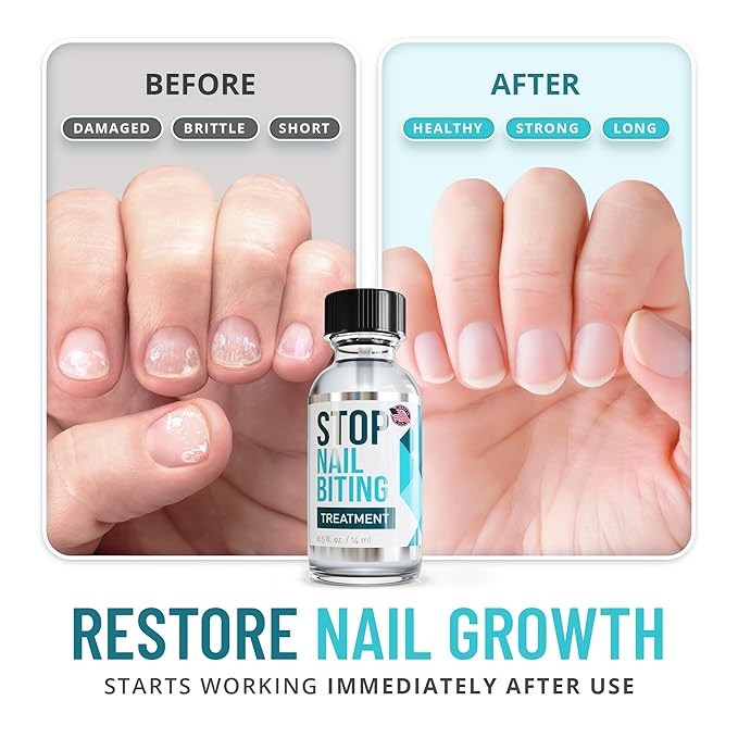 Stop Nail Biting Treatment - Clear, Bitter-Tasting Nail Polish To Stop Nail-Biting - Easy To Apply and Safe For Children - Nail Strengthener Solution - Nail Care for Healthy Nail Growth (0.5 fl oz)